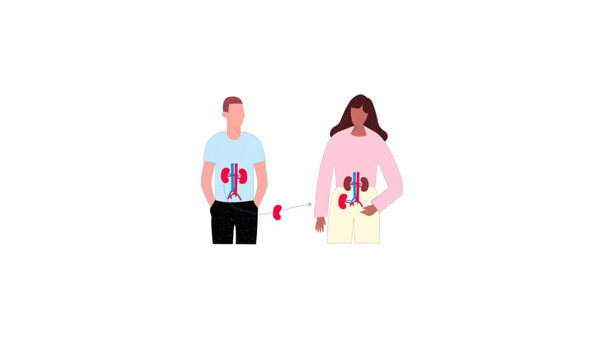illustratie van een niertransplantatie